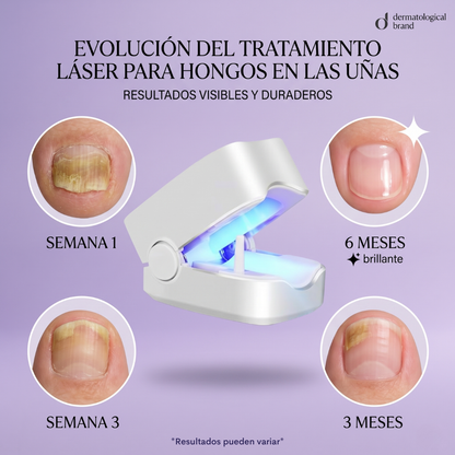 Dispositivo Anti-Hongos Pro ✨