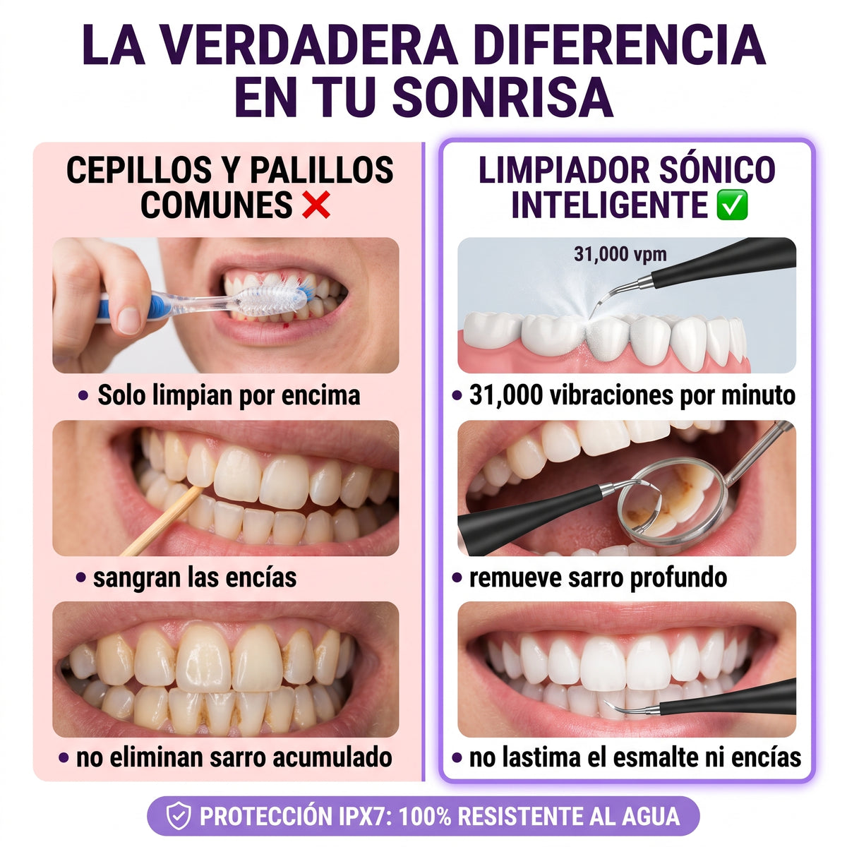 SonicClean Pro — Limpiador Dental Eléctrico | ⚡ Oferta por Tiempo Limitado