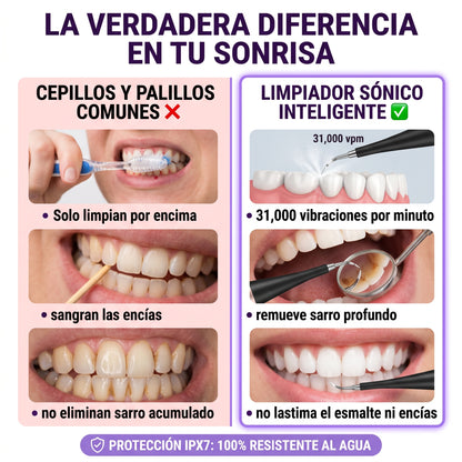SonicClean Pro — Limpiador Dental Eléctrico | ⚡ Oferta por Tiempo Limitado